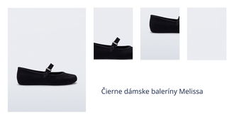 Čierne dámske baleríny Melissa Soft Ballerina Velvet 1